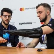 Двом українським воїнам виготовили біонічні протези від британської компанії