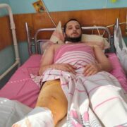 Прикарпатців просять допомогти військовому, який на фронті втратив частину ноги