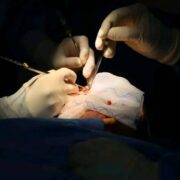 У Франківську завершилася міжнародна місія реконструктивної хірургії для поранених військових